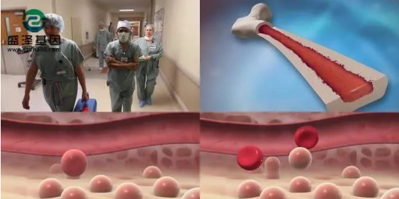 醫(yī)學(xué)怪病奇美拉現(xiàn)象：親自生未必是親生？你身體還住著另一個(gè)人？