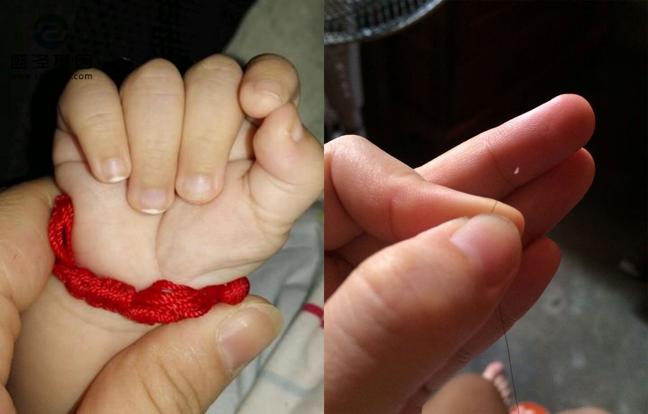 親子鑒定樣本怎么采集？采集頭發(fā)