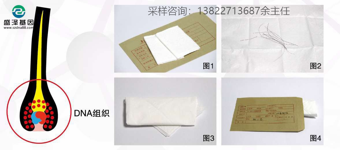 個人親子鑒定簡單采樣方法指導(血痕、口腔拭子、毛發) 個人親子鑒定簡單采樣方法指導(血痕、口腔拭子、毛發)