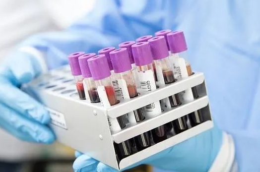 胎兒還沒有生下來能不能做親子鑒定采集羊水？