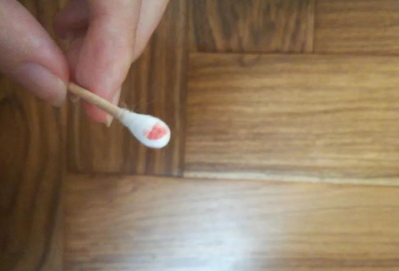 煙頭、血痕、毛發(fā)，做親子鑒定用哪些樣本最為準(zhǔn)確？