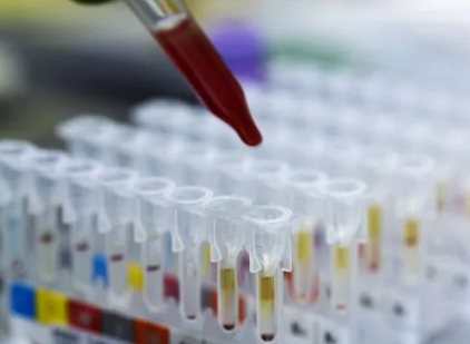 探秘個(gè)人親子鑒定和司法親子鑒定，什么是兩聯(lián)體、三聯(lián)體？