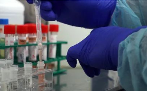 為您細數男方女方做親子鑒定的各種原因，包括：撫養費和第三者...