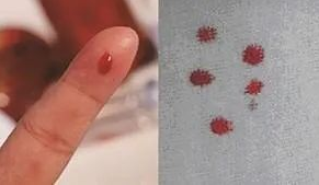 想帶小孩去做親子鑒定該如何取證呢？用紗布或棉簽等采集樣本