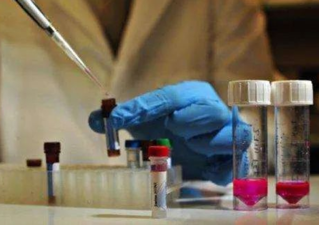 做親子鑒定到底是去醫(yī)院還是去有資質(zhì)的正規(guī)親子鑒定機(jī)構(gòu)？