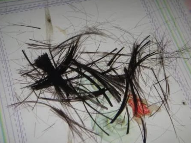 剪下來的頭發沒有毛囊可以做親子鑒定樣本嗎？