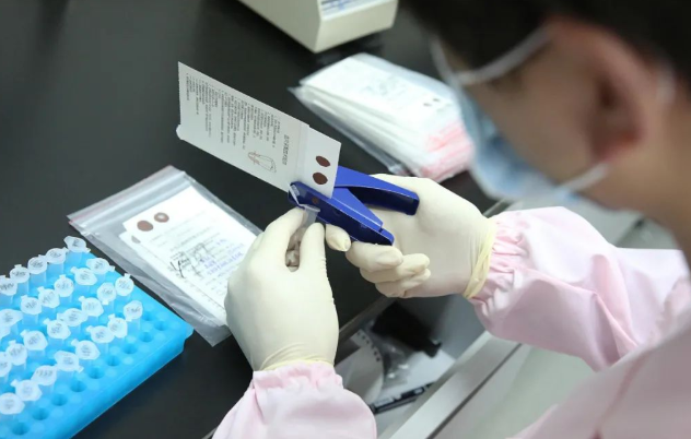 怎么進行親子鑒定最方便？