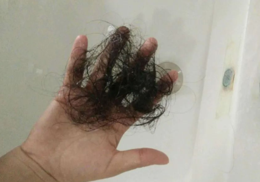 毛發可以做親子鑒定檢材嗎，怎么采集樣本才可以？