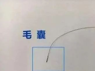 毛發可以做親子鑒定檢材嗎，怎么采集樣本才可以？