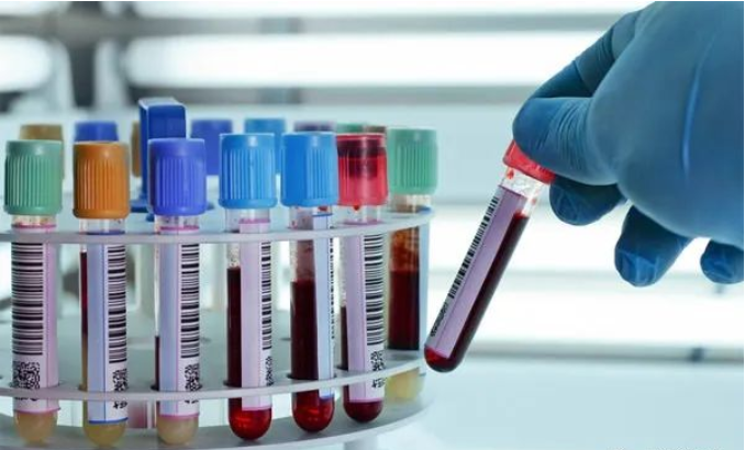 香港Y化驗(孕期驗血)-驗血查男女檢測原理是 香港Y化驗(孕期驗血)-驗血查男女檢測原理是