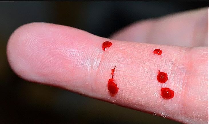 中山東升鎮能不能做親緣親子鑒定？東升鎮姐弟怎么做親子鑒定