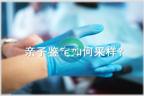 中山親子鑒定和親緣鑒定是一樣的嗎？