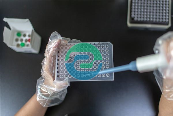 中山親子鑒定的費(fèi)用受到若干因素的影響