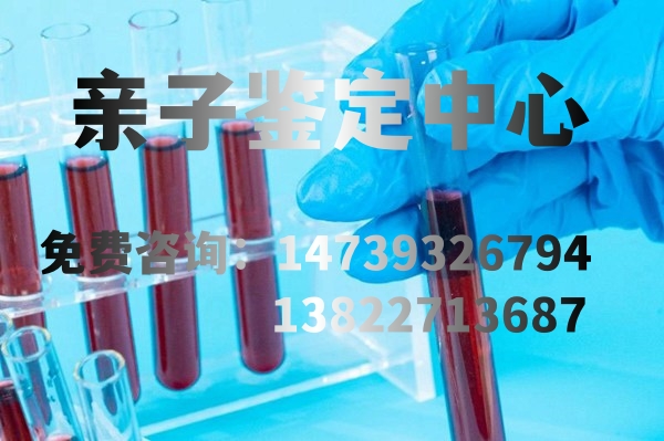 中山親子鑒定是用科學的方法來判斷父母與子女之間的親緣關系